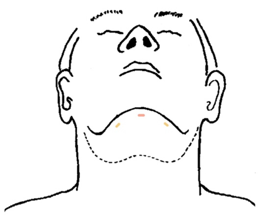 Ilustrace k zákroku