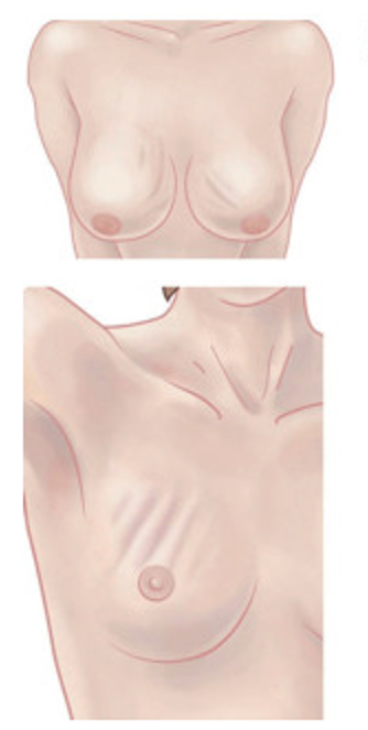 Ilustrace k zákroku